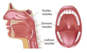 Gerklė