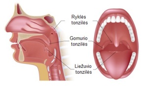 Tonzilės