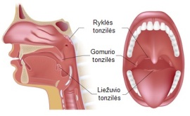 Gerklė