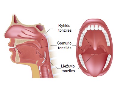 Tonzilės, gerklė