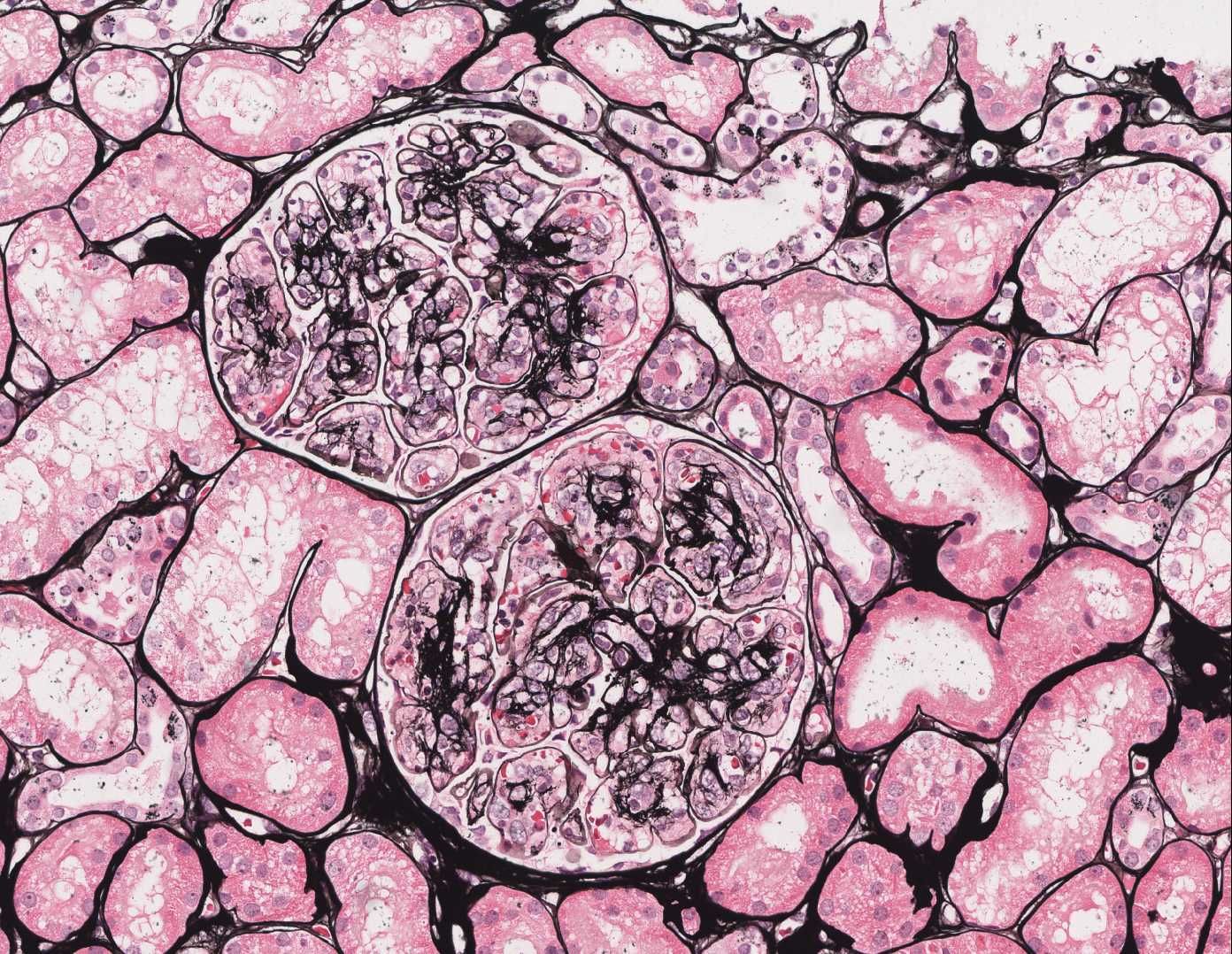 Inkstų glomerulų membranas išryškinantis dažymo metodas