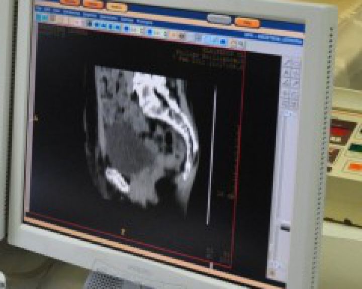 Lietuvos pacientų sveikatos būklė nuo šiol stebima ir nuotoliniu būdu  