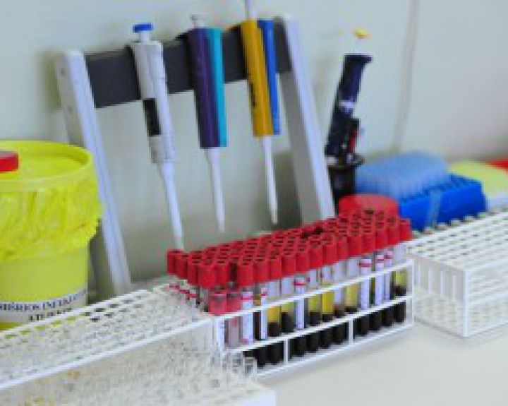  Į ligoninę pateko dar vienas meningokokine infekcija užsikrėtęs moksleivis