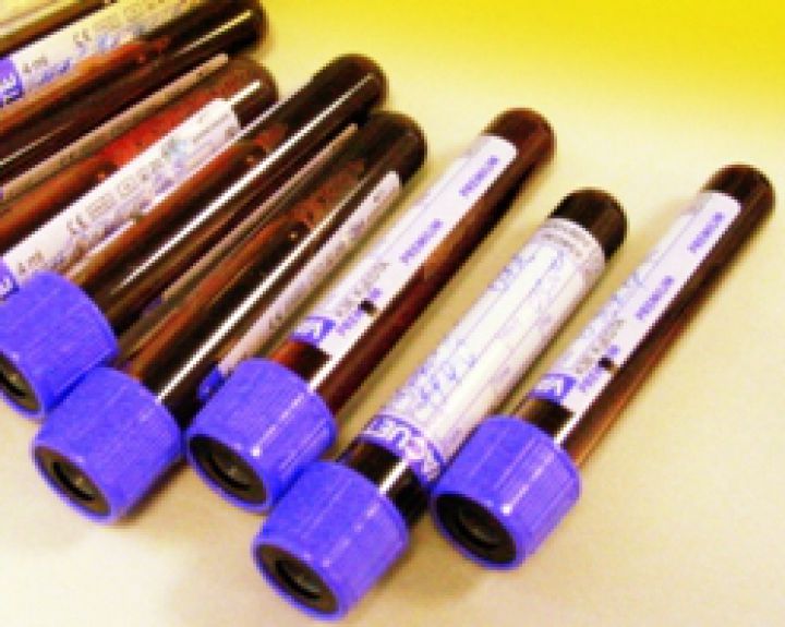 Patvirtintas ambulatorinių urologijos paslaugų aprašas