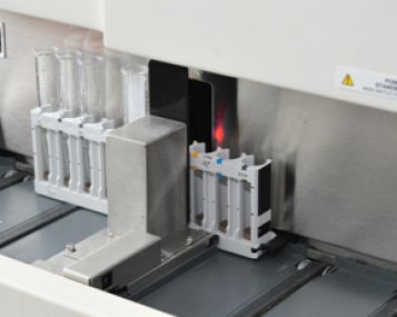 Susirgimų pneumokokine infekcija mažėja, tačiau ligos sukėlėjas tampa sunkiau įveikiamas