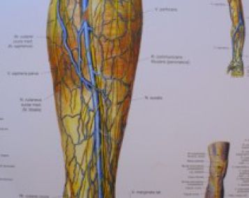 Aspirinas gali apsaugoti nuo trombozės atsinaujinimo 