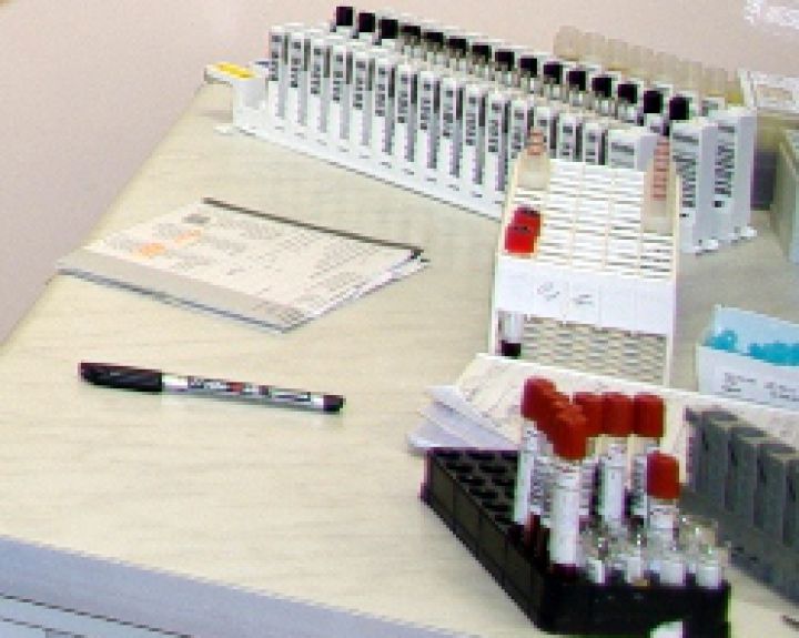 Atliktas tyrimas apie ankstyvos diagnostikos programų įgyvendinimą Lietuvoje