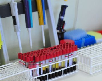 Sepsis: kaip jį pažinti ir gydyti