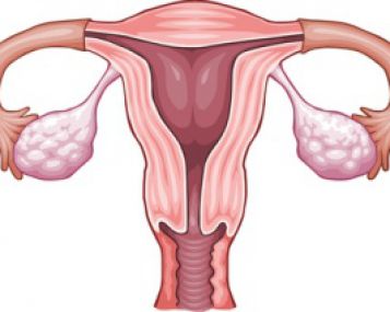 Kaip pesticidai susiję su endometrioze