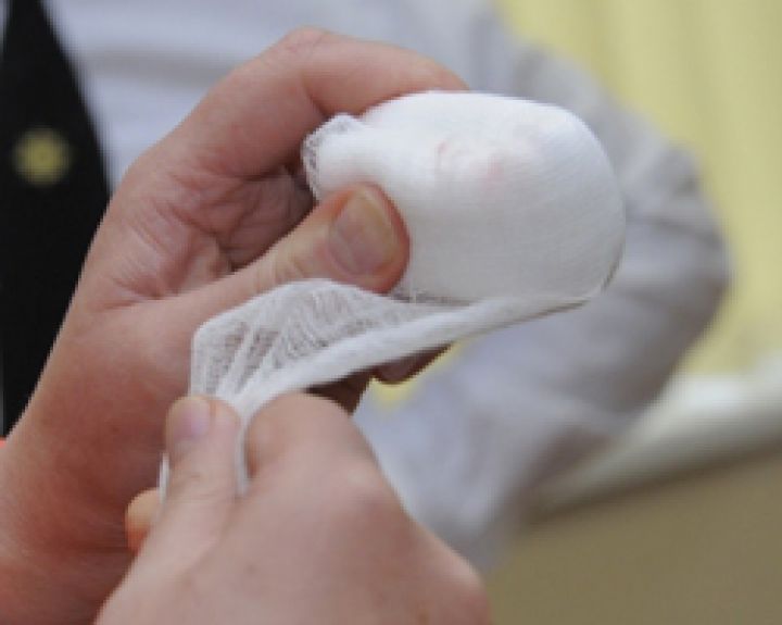 Žaizdų gijimas priklauso nuo odos bakterijų sudėties