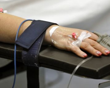 Cezario pjūvis gali turėti įtakos naujagimio genų aktyvumo pokyčiams 