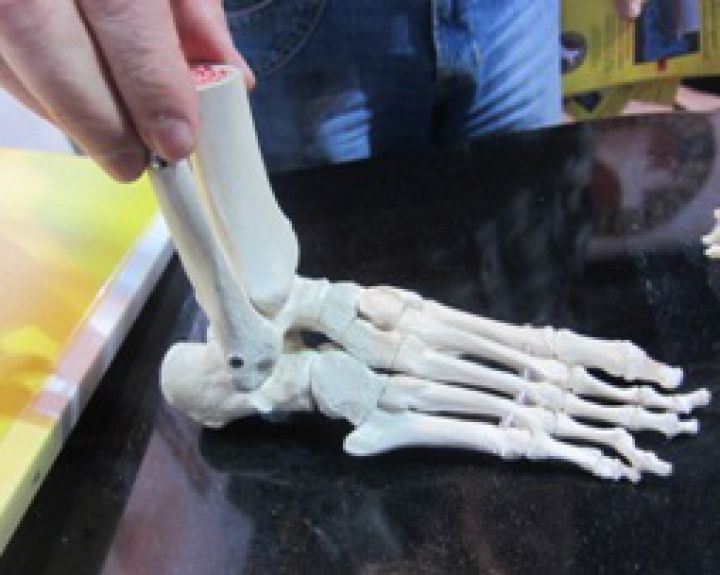 Osteoporozės atvejais kaulų tankio matavimas po gydymo mažai informatyvus