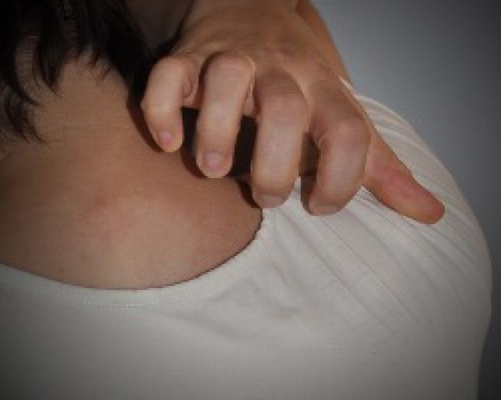 Antikūnas prieš interleukiną-17 efektyvus sergant psoriaze