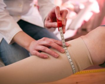 Nėštumo metu – skauda kojas, susidarė mėlyni kraujagyslių rezginiai 