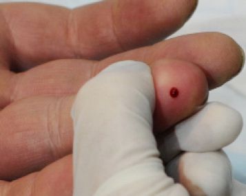 Anglijoje pradedama prekyba namudiniu ŽIV testu 