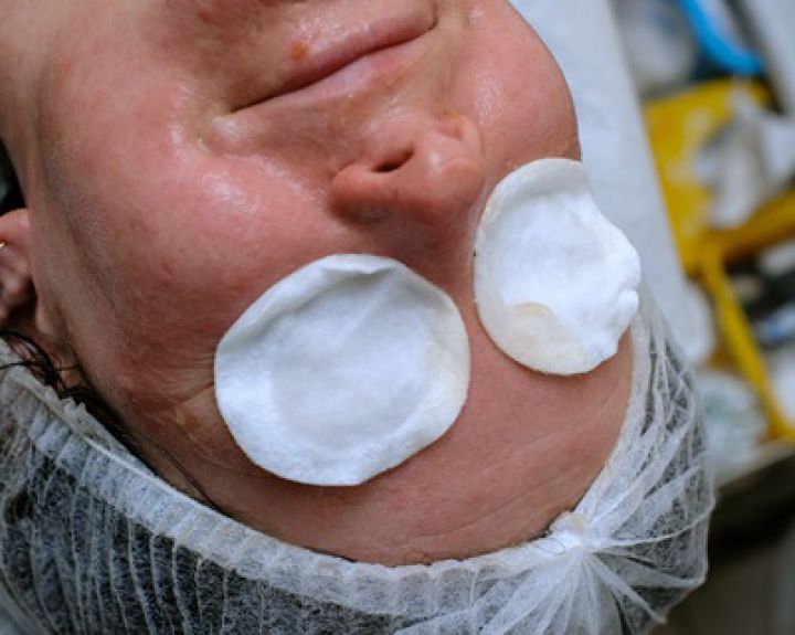 Parafino kaukės - prevencinė priemonė prieš senėjimą