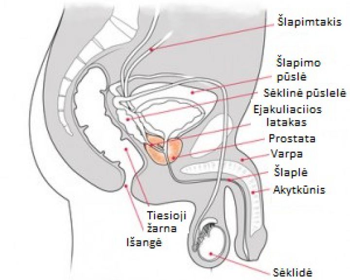 varpos tiesiosios žarnos srityje