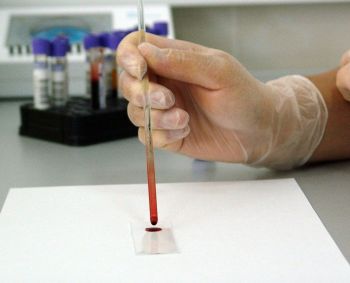 Vyriausybė pritarė pilotiniam profilaktinių COVID-19 tyrimų projektui   