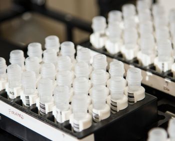 Rūpestį keliančios SARS-CoV-2 viruso atmainos nerasta, bet aptikta kitokia