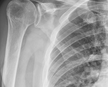 Santaros klinikose – dar didesnės donorinių audinių panaudojimo galimybės