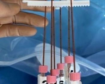 Nobelio premiją pelnęs atradimas pasitarnauja gydant melanomą