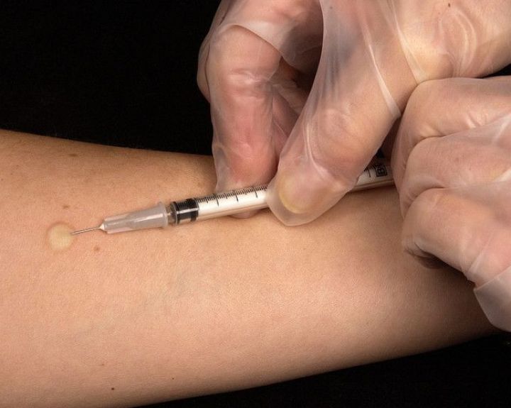 Ragina pasinaudoti nemokama galimybe atlikti tuberkulino mėginį