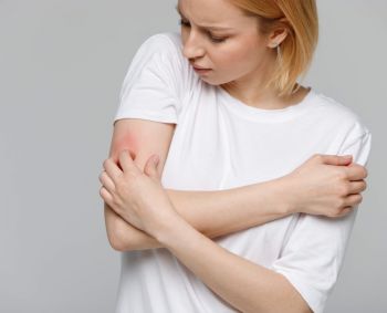 Kontaktinio dermatito paslaptys: dėl ligos tenka keisti ir profesiją