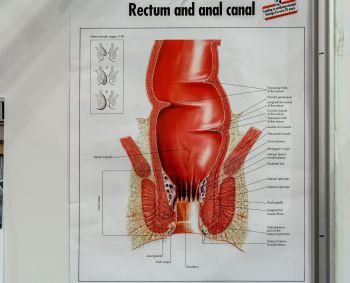 Nemalonūs tiesiosios žarnos tyrimai būtini ankstyvai rimtų ligų diagnostikai
