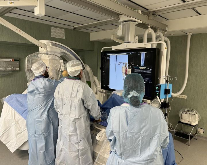 Užkalkėjusias kraujagysles plės intravaskulinės litotripsijos aparatu