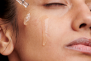 Kaip rūpintis jautria veido oda vasarą: pravers 5 taisyklės