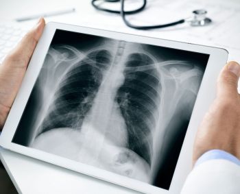 Radiologijos technologo profesija: nepakeičiama net dirbtinio intelekto eroje 