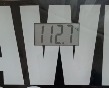 Turiu individualią veiklą. Ar kompensuojamas nutukimo gydymas?