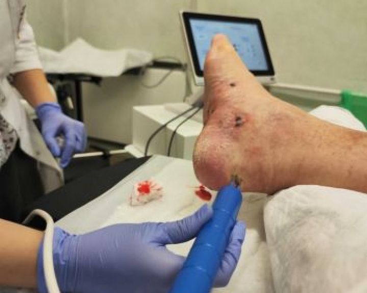 Inovatyvus gydymas padėjo suvaldyti retą onkologinę ligą