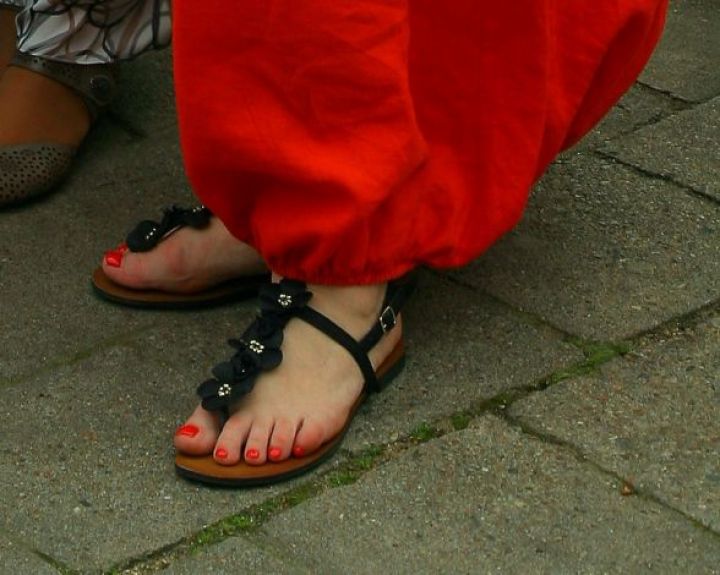 Pakito nago spalva. Ar tai gali būti grybelis?