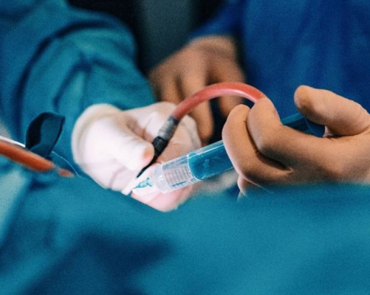 Pirmą kartą Baltijos šalyse – unikalus inksto arterijos aneurizmos gydymas