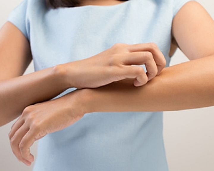 Pavasario įtaka odai: atopinio dermatito pažeista oda atvira infekcijoms