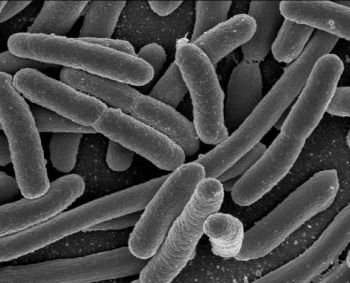 Neurodegeneracinių ligų kaltininkės – žarnyne gyvenančios bakterijos