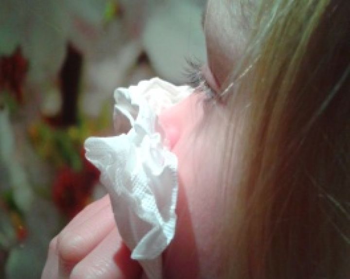 Kraujavimas iš nosies. Ką daryti?
