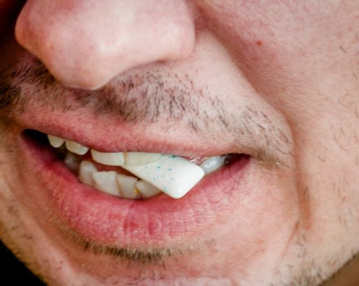 Nemalonų burnos kvapą lemia ne tik maistas ar prasta burnos higiena