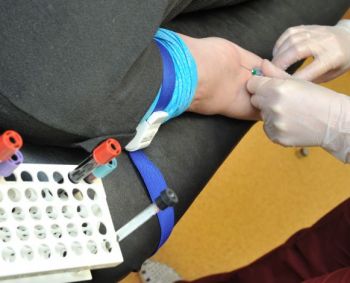 Urologas ragina vyrus pasitikrinti savo sveikatą jau šiandien