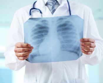 Plaučių uždegimas: kada nekalti simptomai ima grėsti gyvybei