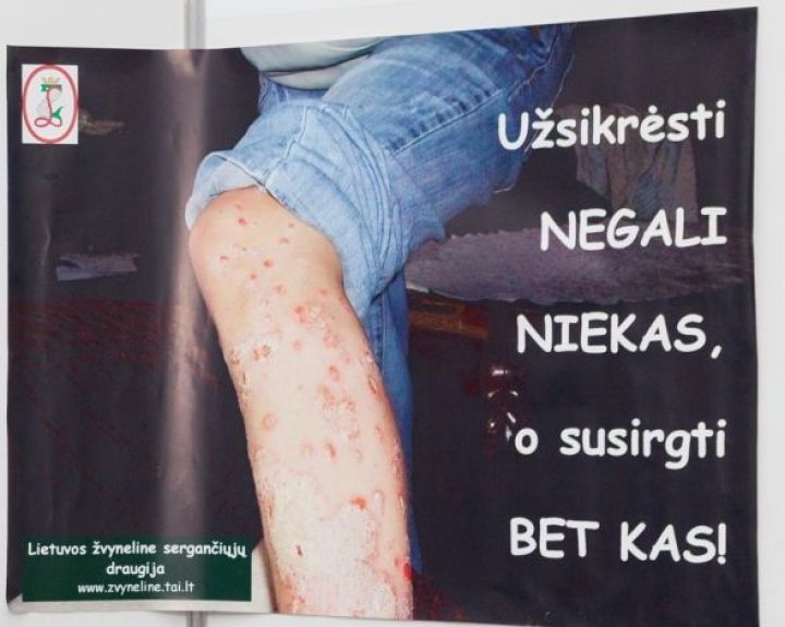 Rado būdą, kaip sutramdyti psichologiškai ir fiziškai sekinančią ligą  